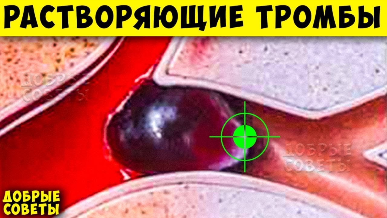 СуперПродукты, которые Чистят кровь от Тромбов + Народные средства