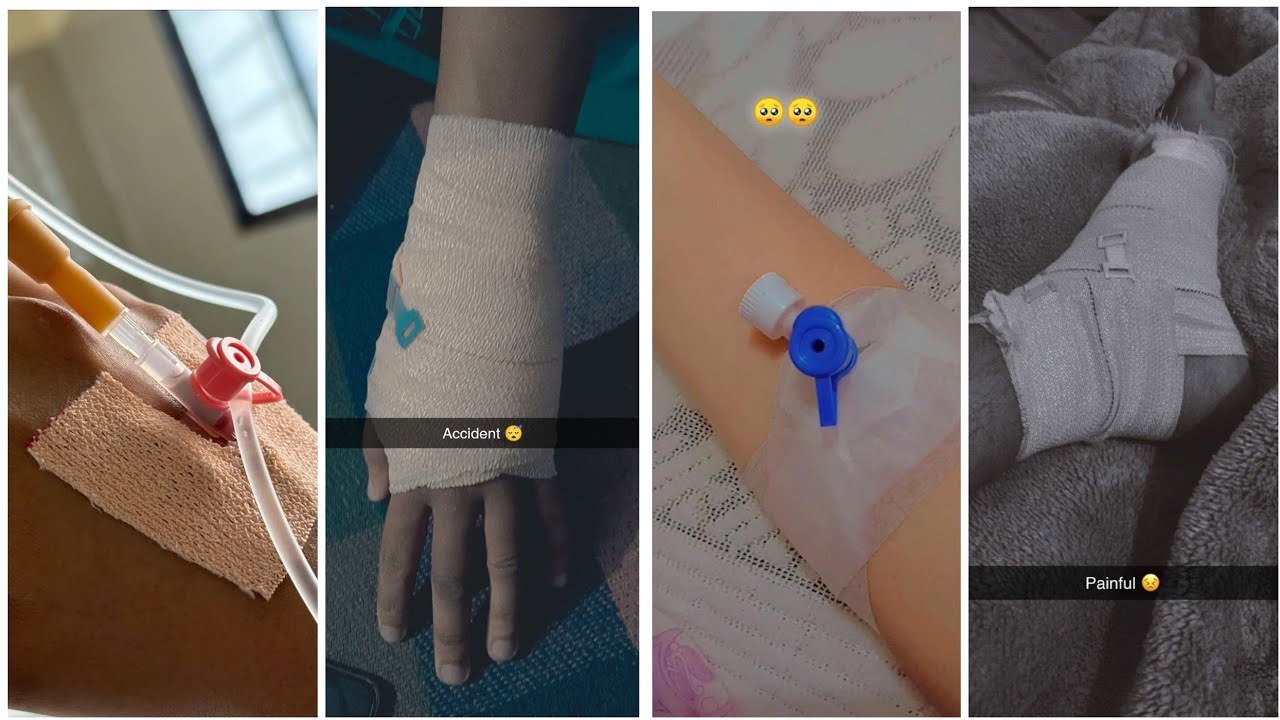 🤕😭 𝐅𝐚𝐤𝐞 𝐚𝐜𝐜𝐢𝐝𝐞𝐧𝐭 𝐝𝐩 𝐢𝐦𝐚𝐠𝐞'𝐬 𝐟𝐨𝐫 𝐖𝐡𝐚𝐭𝐬𝐀𝐩𝐩 𝐈𝐧𝐬𝐭𝐚𝐠𝐫𝐚𝐦 || 𝐀𝐝𝐦𝐢𝐭 𝐢𝐧 𝐡𝐨𝐬𝐩𝐢𝐭𝐚𝐥 𝐝𝐩𝐳 ||