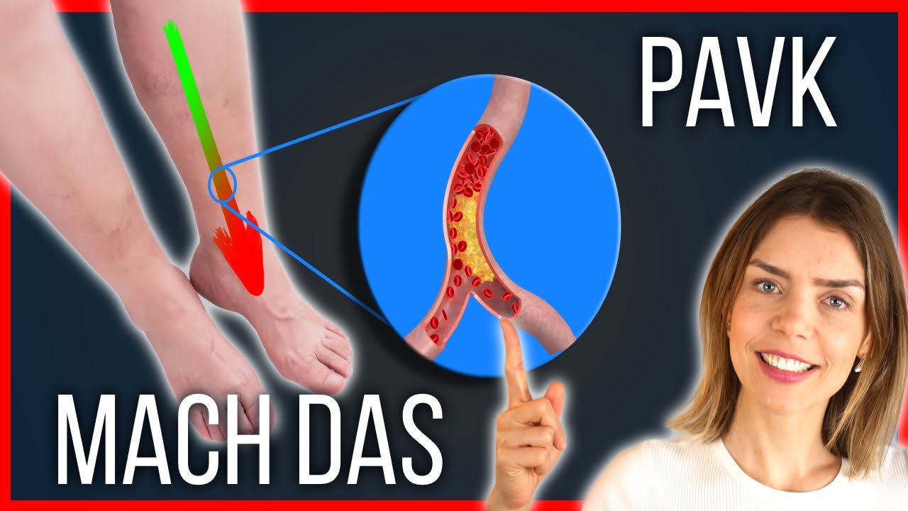Verkalkte Gefäße? Gehstrecke mit diesen Übungen steigern und Schmerzen lindern