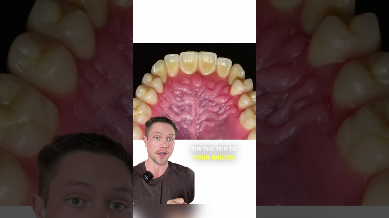 The #1 Sign You Have A Dysfunctional Tongue (this can ruin your posture)