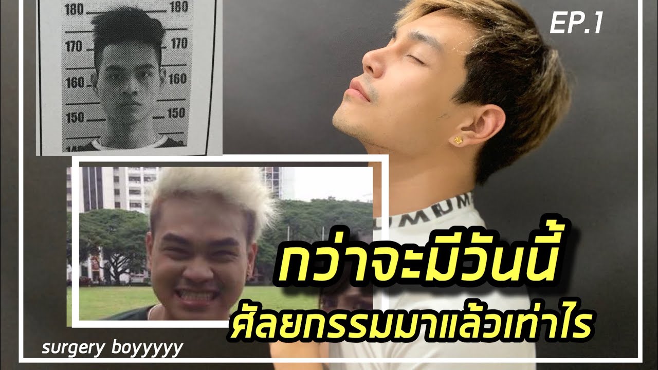 เปิดหมด ศัลยกรรมผู้ชาย  ทำที่ไหน งานดี?????? / Surgery boyyyyy EP.1