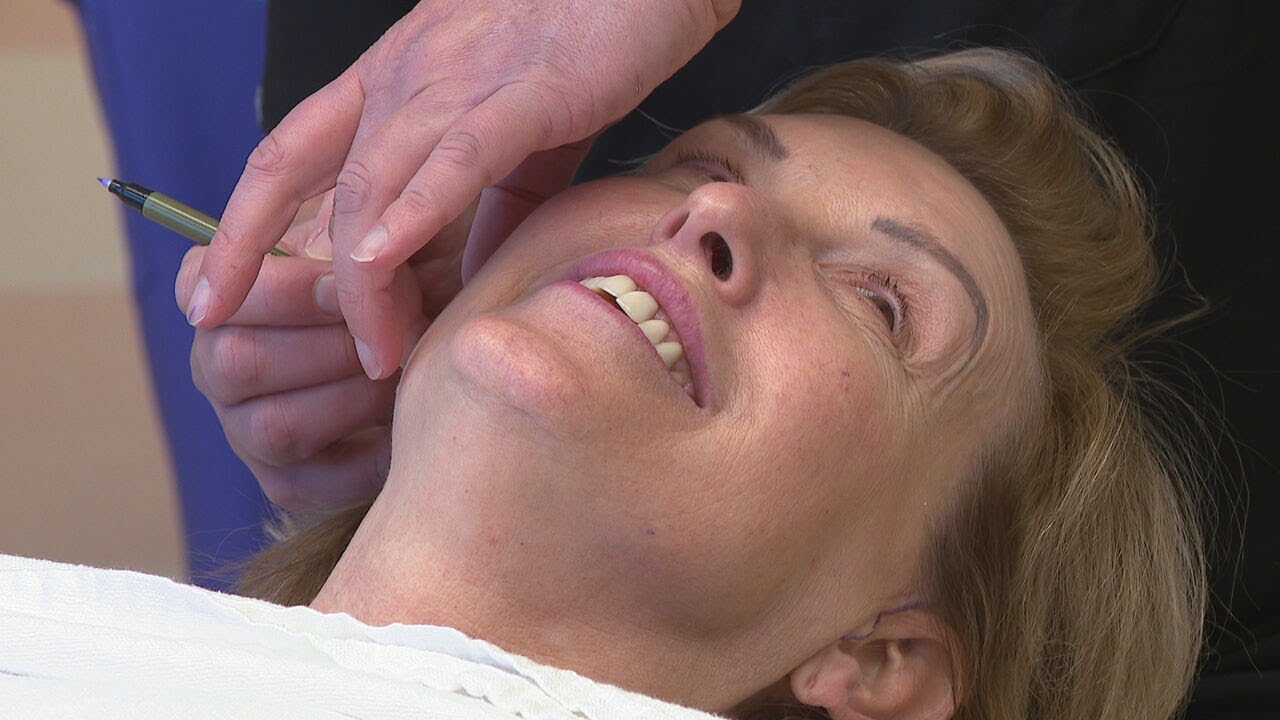 Natural looking facelift is popular plastic surgery procedure for 2024