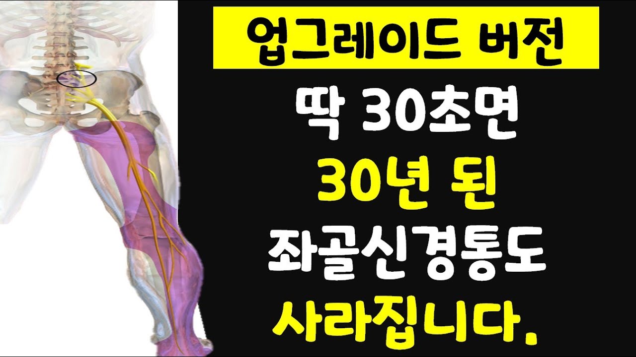 30초만에 방사통 일명 좌골신경통 즉시 없애주는 기가 막히는 운동 (업그레이드 버전)