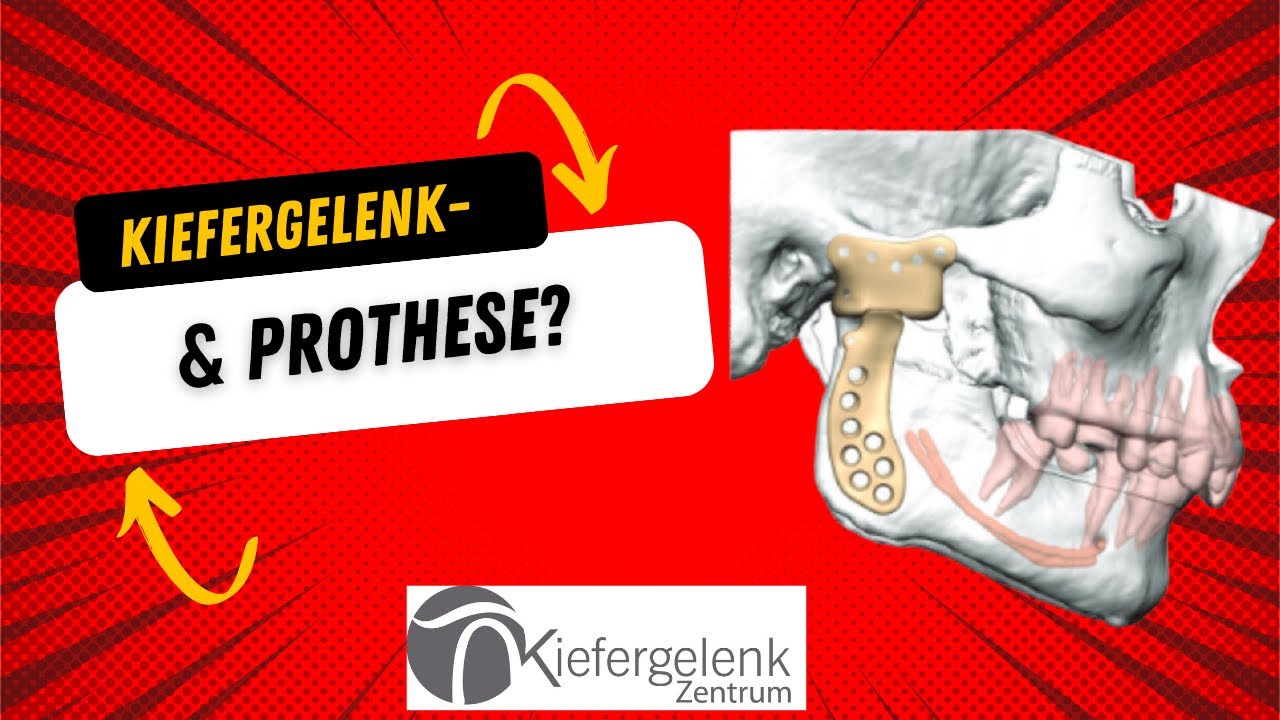 Prothese für das Kiefergelenk?