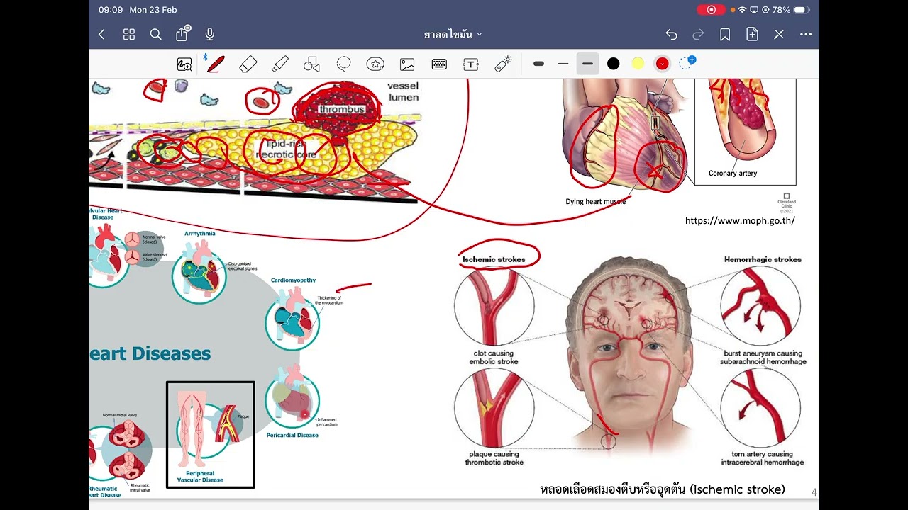 ยาลดไขมัน (PMC101)