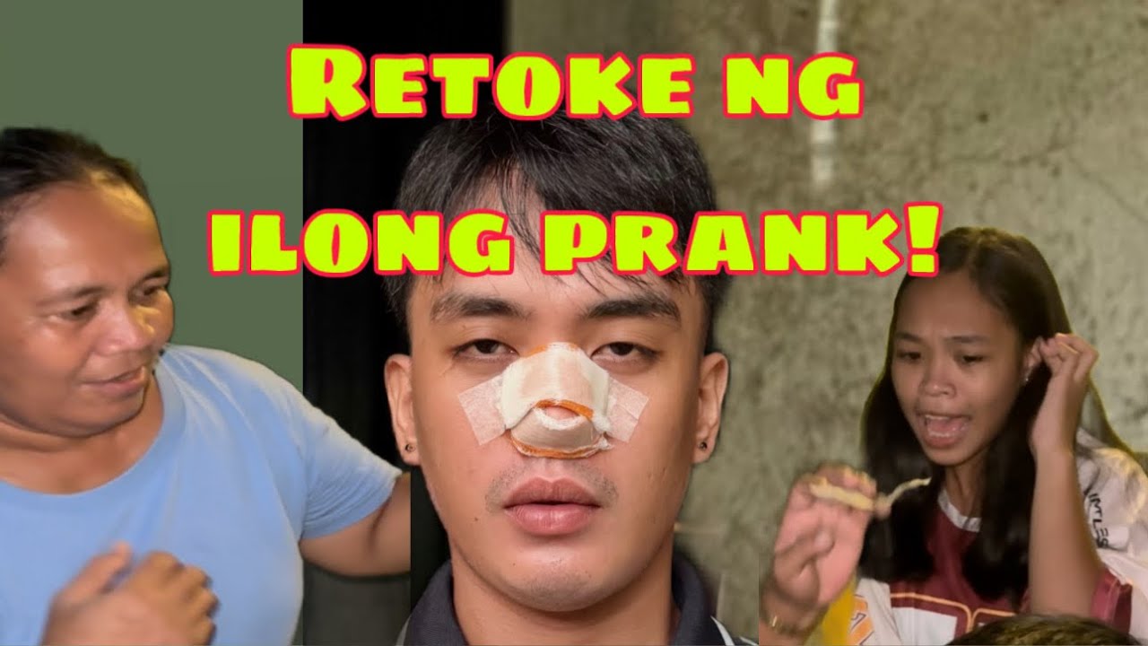 “Nagpa-retoke ng Ilong Prank”| Glen Gonzaga 