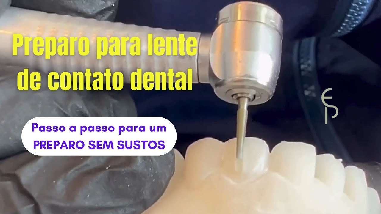 Preparo para Lente de contato dental (laminado cerâmico)