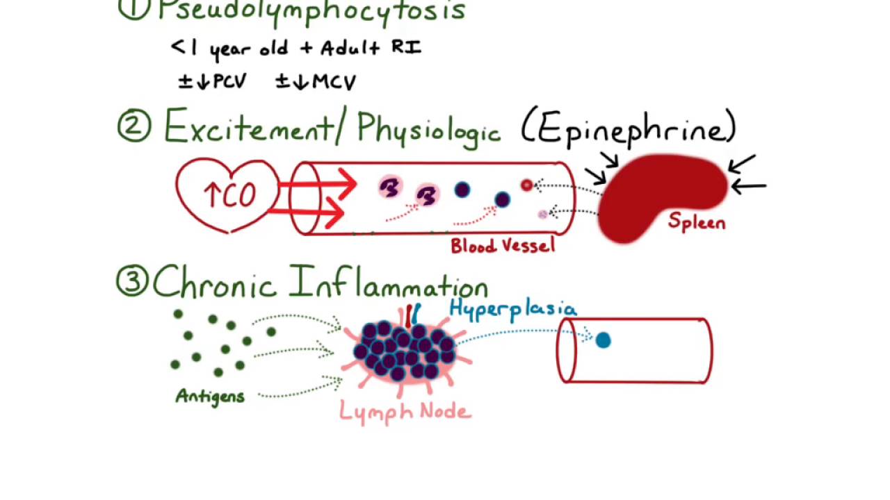 Lymphocytosis