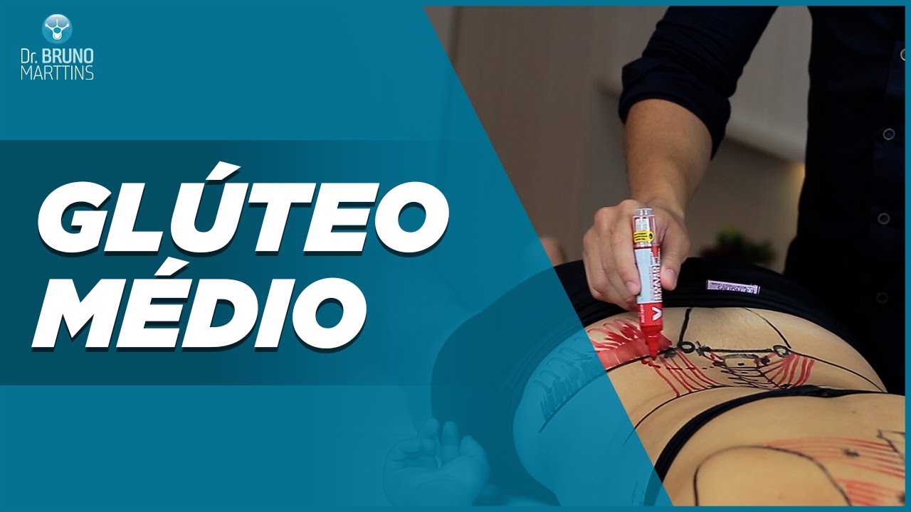 Glúteo Médio - Ponto gatilho
