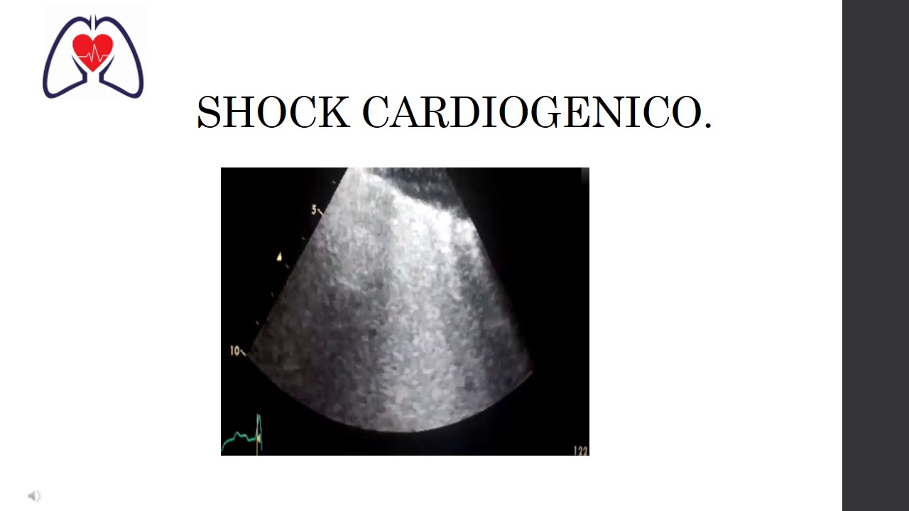 Utilidad del Ultrasonido en el Estado de Choque
