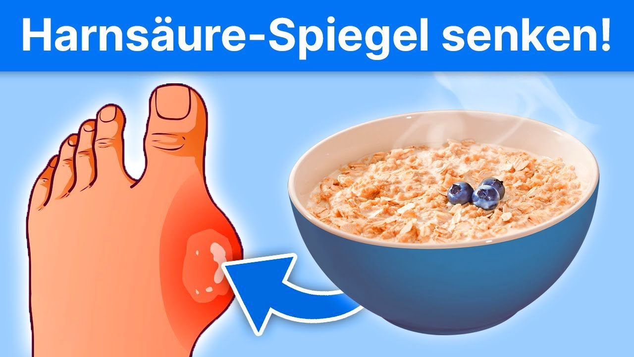 7 Lebensmittel, die deinen Harns&auml;urespiegel senken!