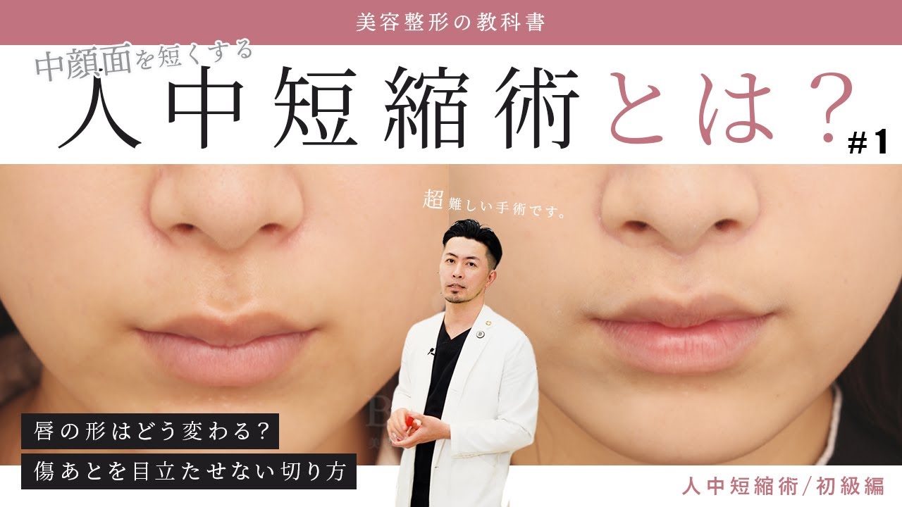 vol.8 