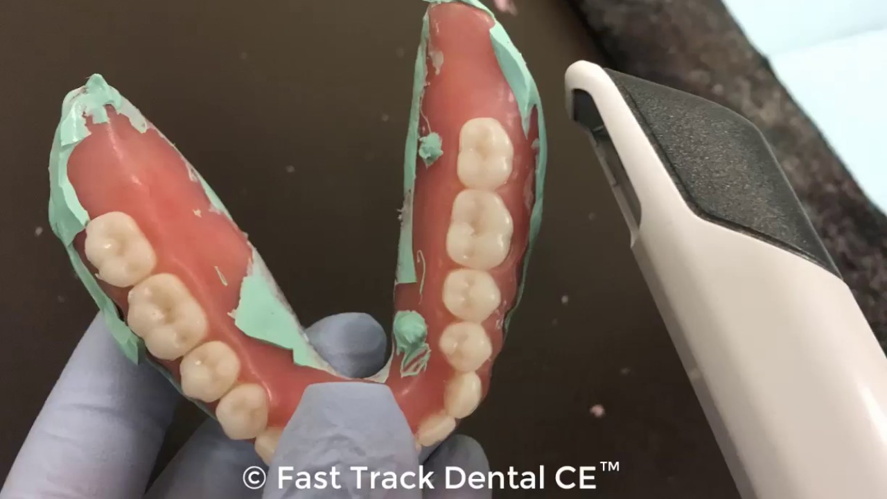 Scanning Radiopaque PVS Relined Denture with TRIOS & Guide Workflow