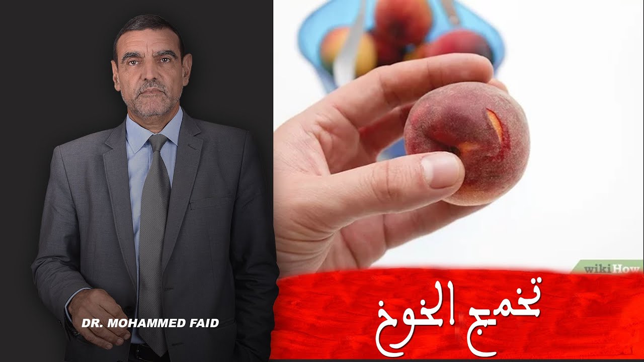تخمج الخوخ علامة جيدة | الدكتور فائد