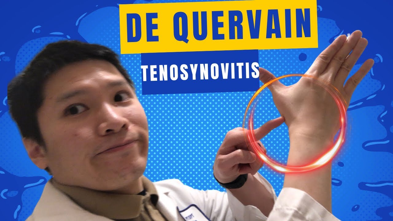 How To Strengthen the Thumb for De Quervain Tenosynovitis
