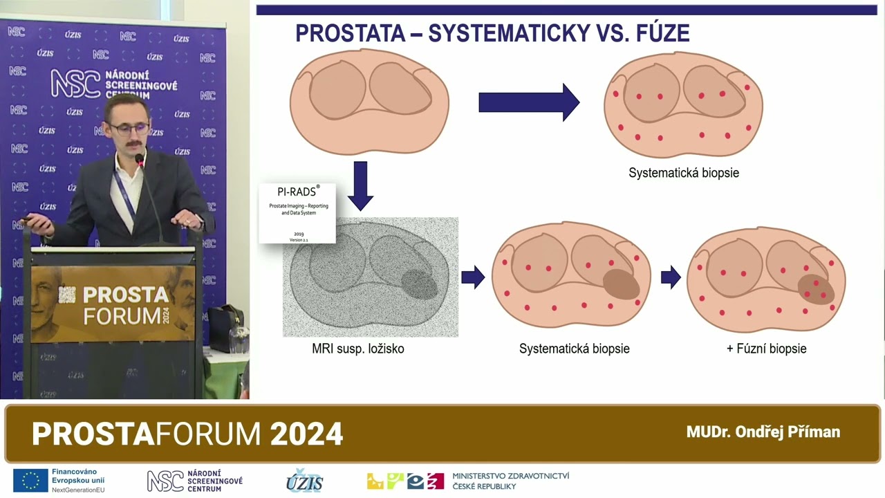 Kdy urolog volí biopsii prostaty? (O. Příman)