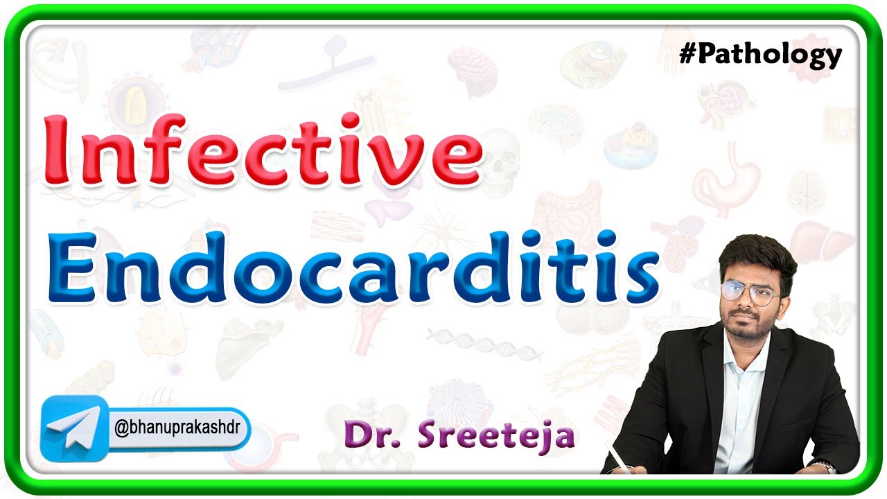 7: Infective Endocarditis : Pathology USMLE Step 1