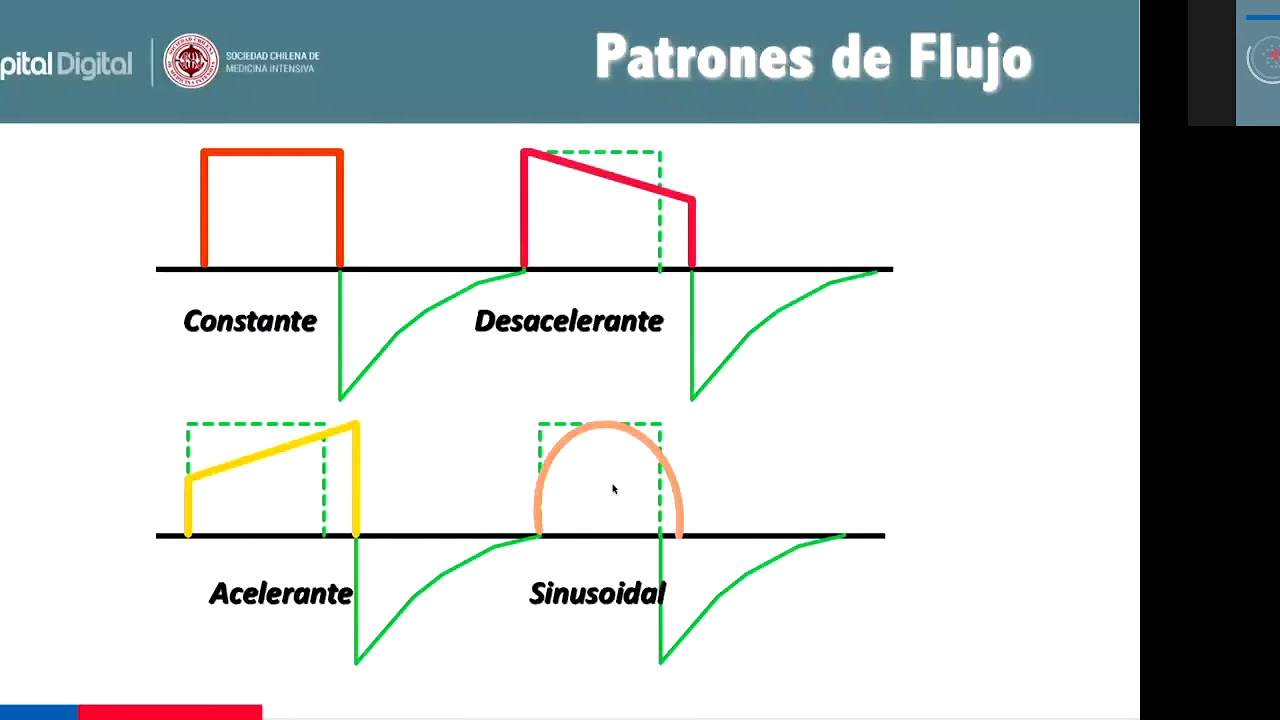 Principios Básicos de Ventilación Mecánica