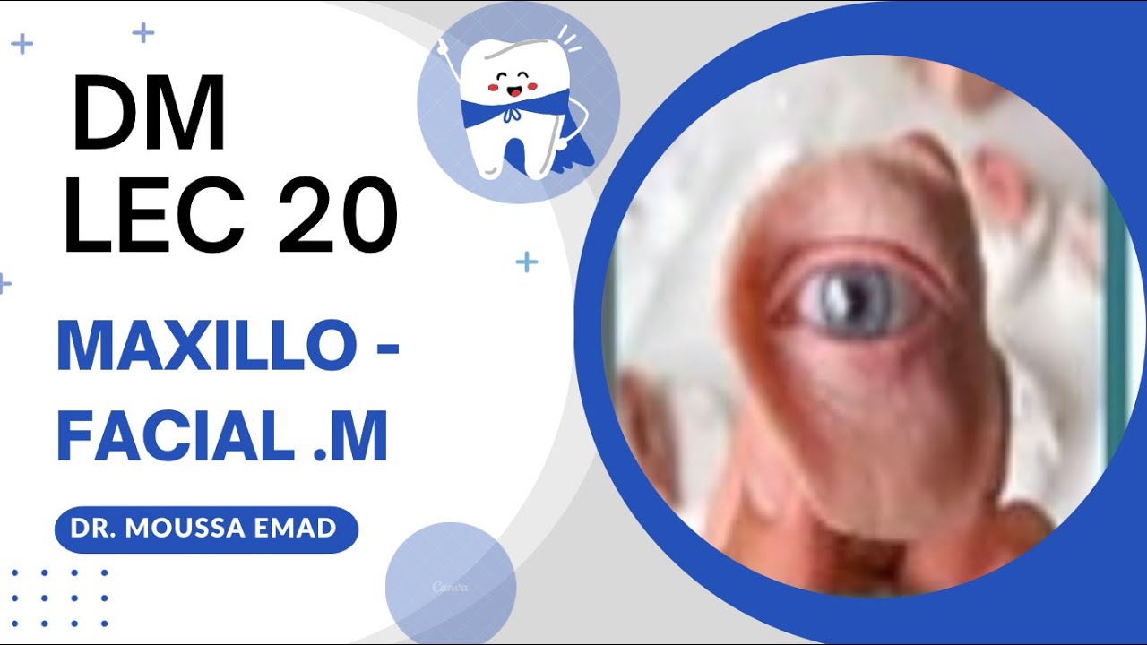لكجر 20 دي ام | Maxillofacial materials | طب اسنان مرحلة ثانية