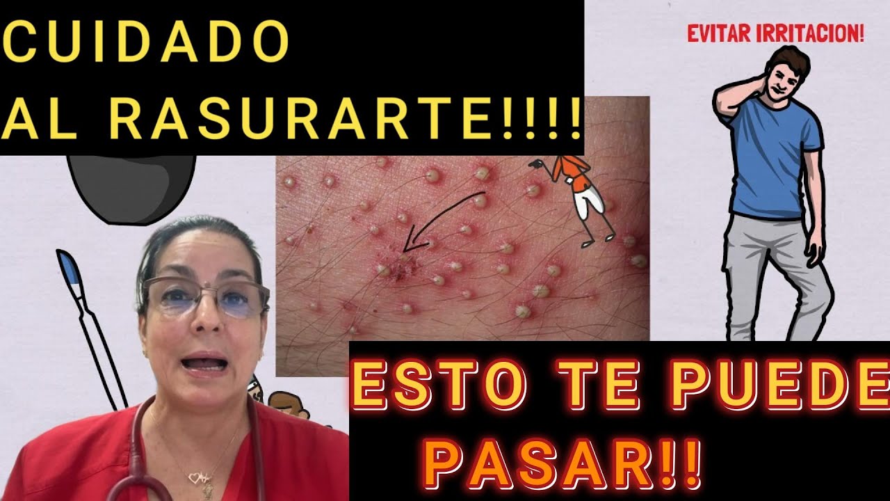 De Un Rasurado .... A la tragedia.....