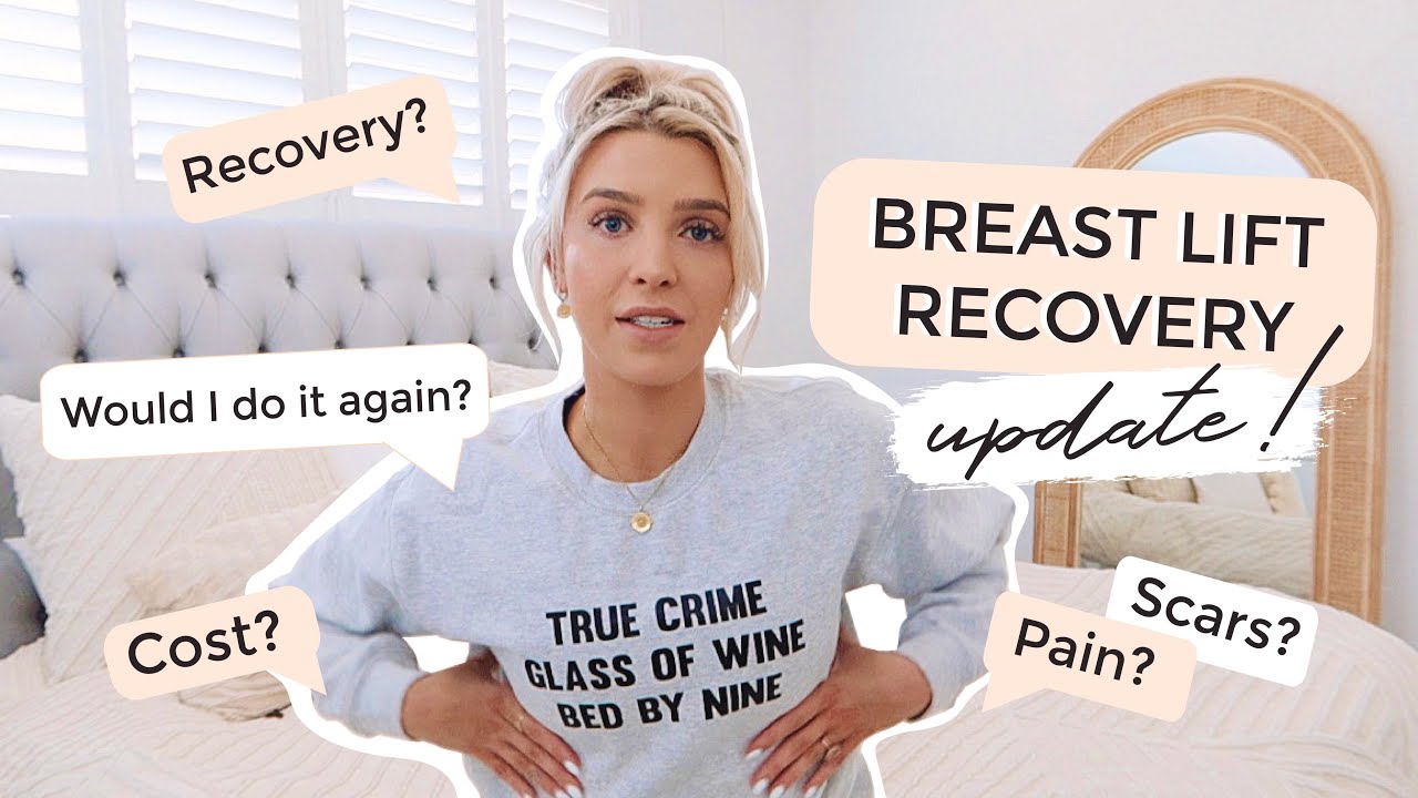 BREAST LIFT UPDATE// SEE MY SCARS/ PAIN/ WOULD I DO IT AGAIN? 5 Months Post-Surgery