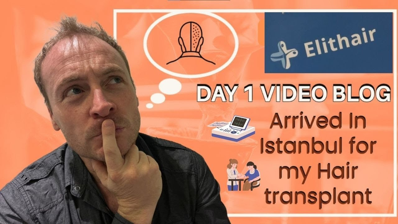 First Day at Elithair for Hair Transplant in Turkey 2022