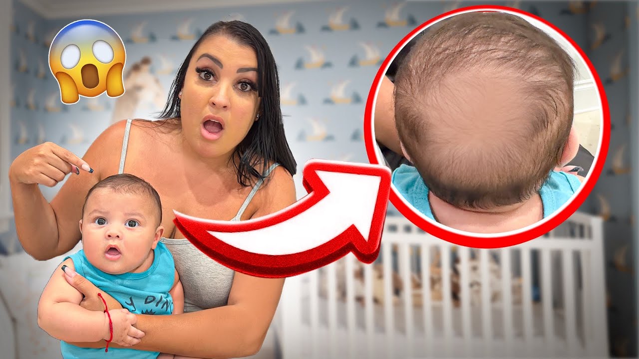 OUR BABY HAS A BALD SPOT