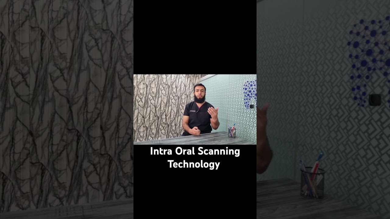 Intra Oral Scanning Technology..... 