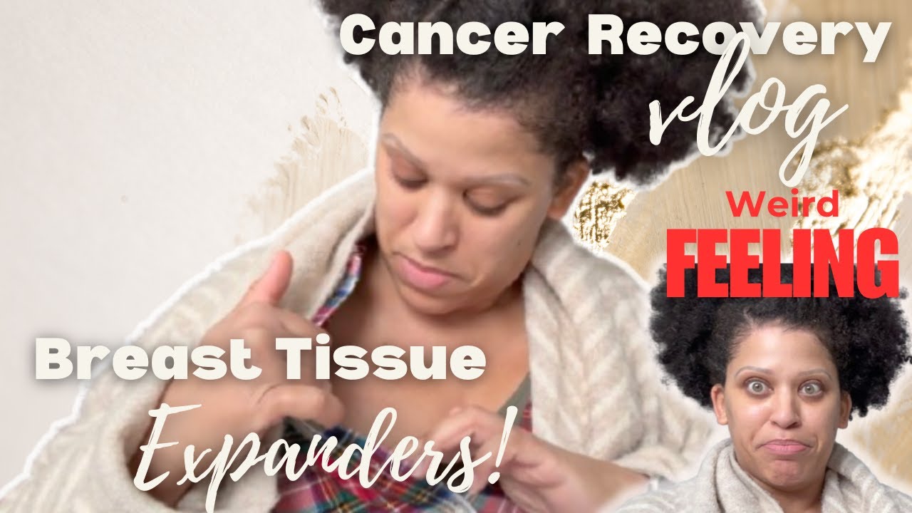 Recovery Day 15 | Tissue Expanders | Bilateral Mastectomy Recovery
