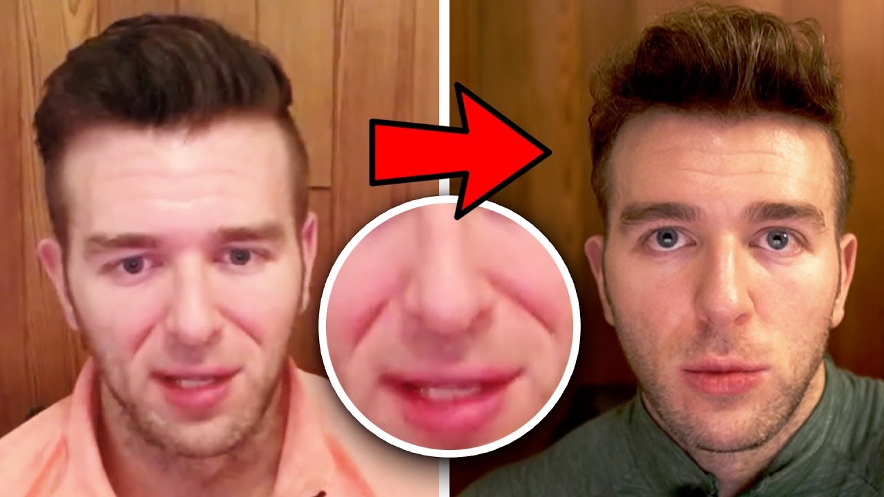 I Tried “Mewing” Every Day For A Year And This Is What Happened…