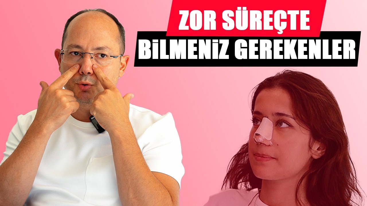 Alçı ve Tamponlarla İlgili Her Şey: Burun Ameliyatı Sonrası İyileşme Süreci