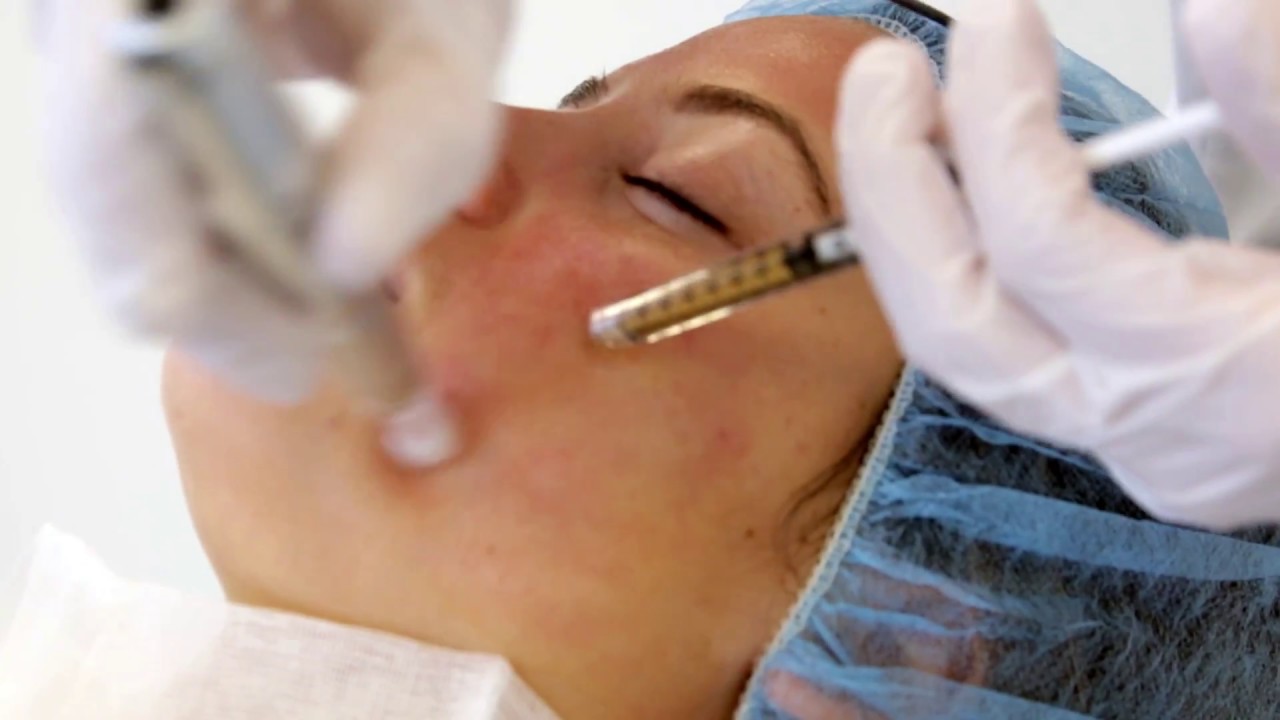 PRP-behandeling | FURROW.NL