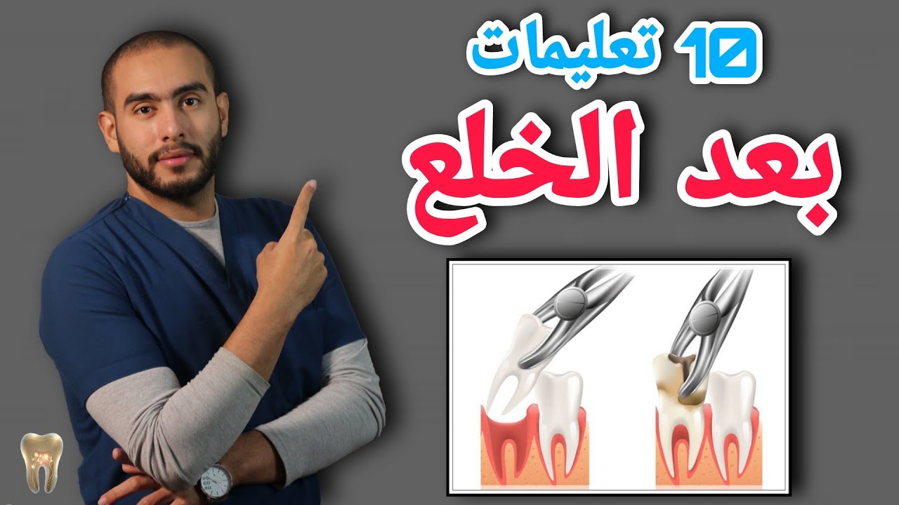 اسباب خلع الضرس جراحيا | تعليمات بعد خلع الضرس | خلع ضرس العقل