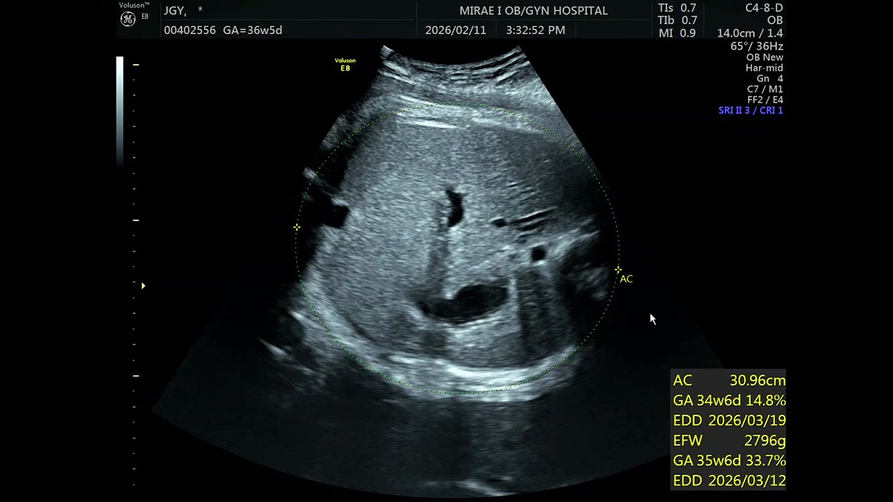 26.2.11.(수) 36주 3일차 