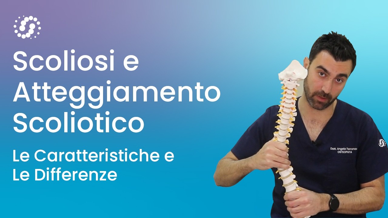 Scoliosi e atteggiamento scoliotico: cosa devi sapere