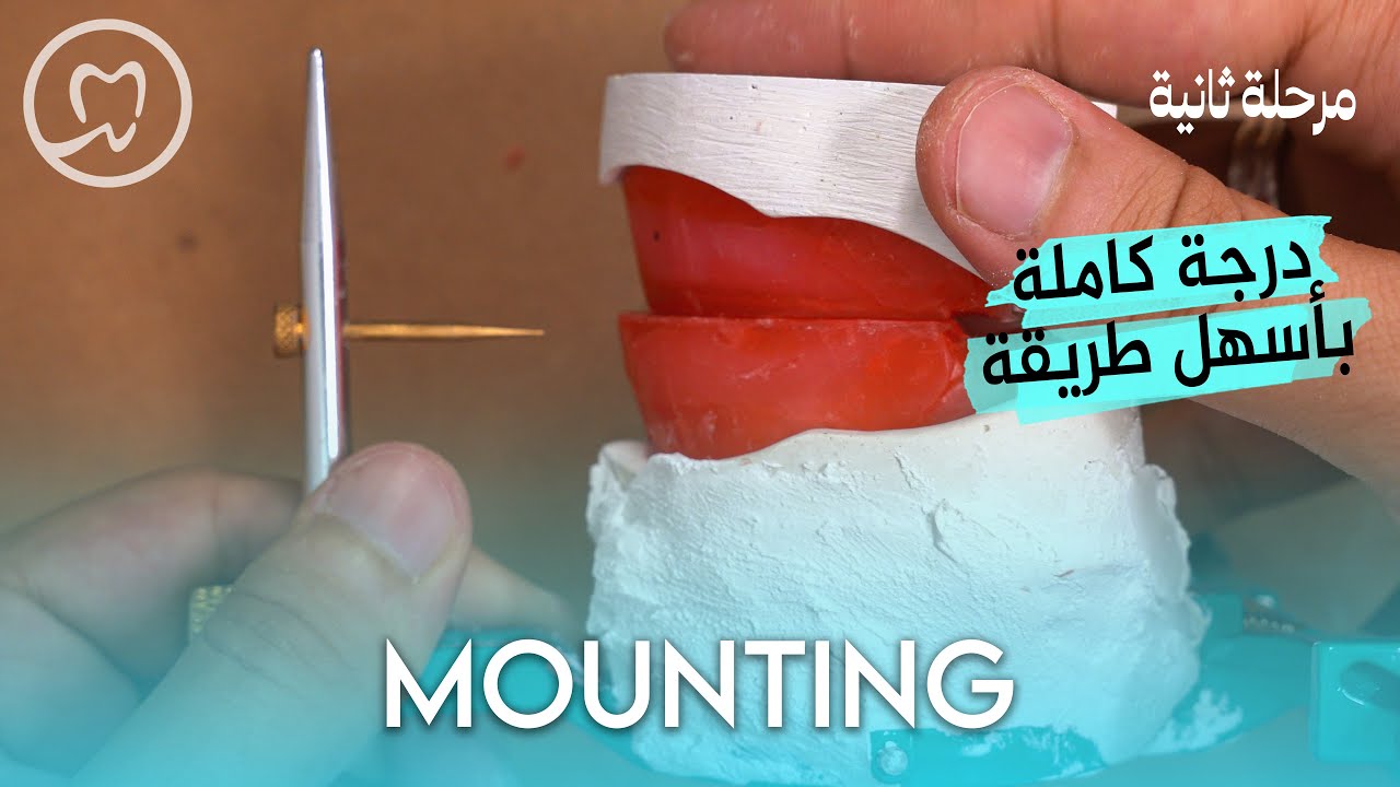Articulator Mounting | خطوة بخطوة - طب الاسنان مرحلة ثانية