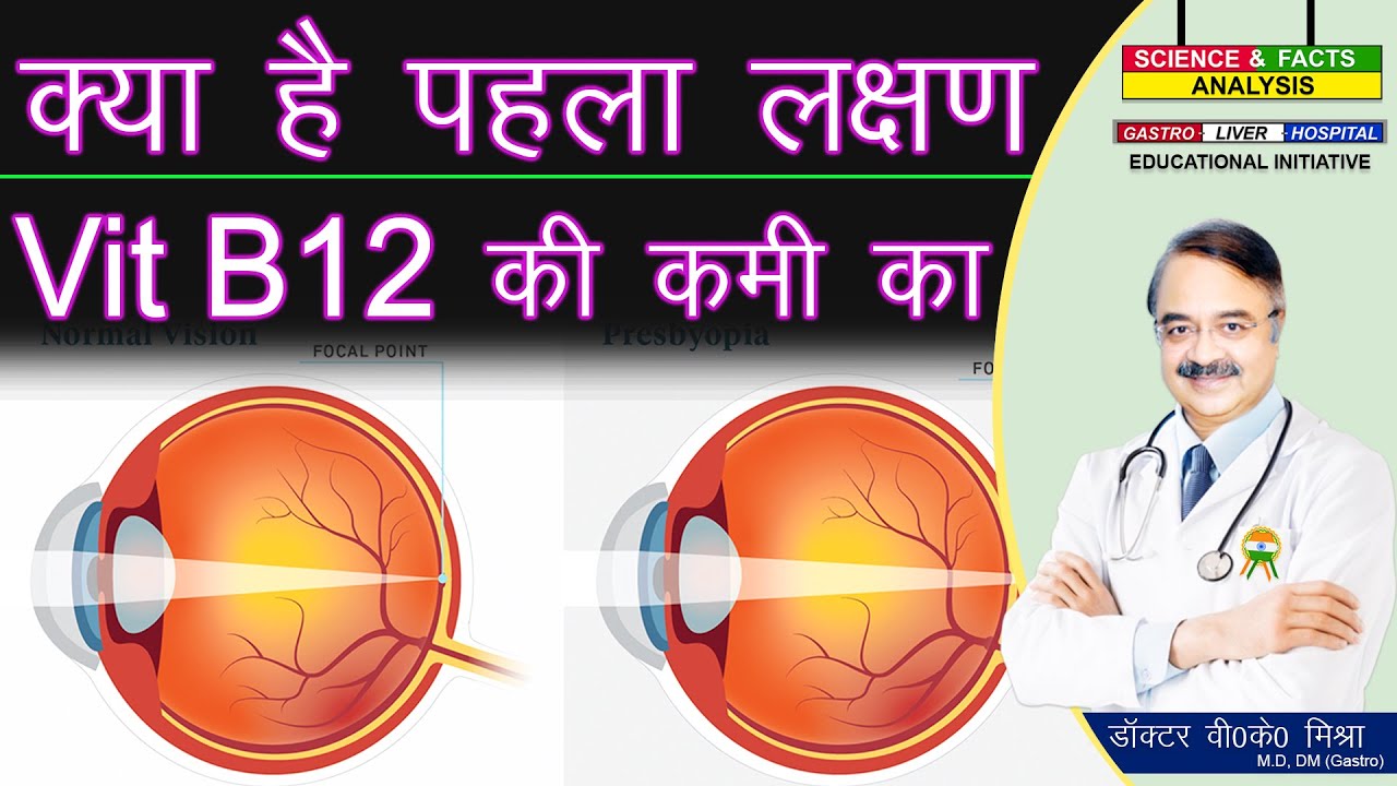 क्या है पहला लक्षण VIT B12 की कमी का || 19 SIGNS OF VIT B12 DEFICIENCY Part 3