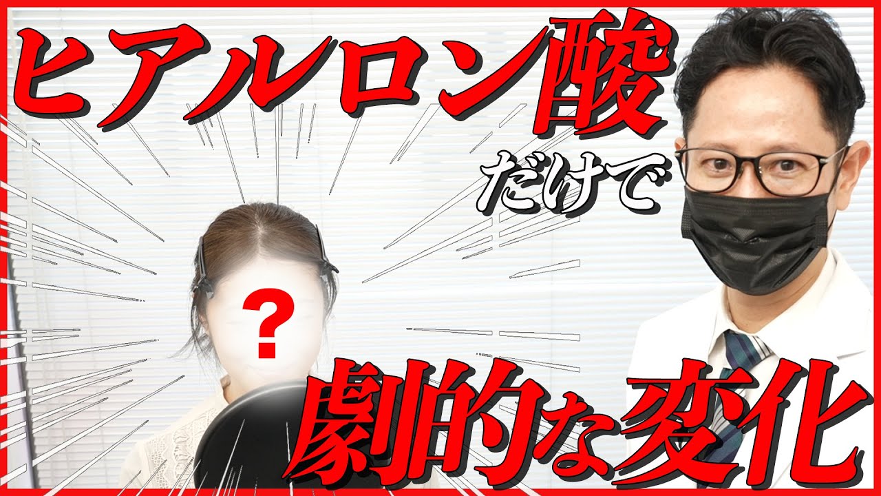 【施術公開】ヒアルロン酸注入だけで可愛くなれるのか【涙袋とほうれい線】
