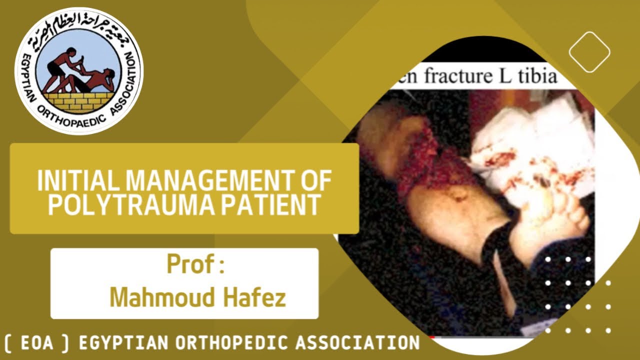 Initial management of polytrauma patient (Prof. Mahmoud Hafez)