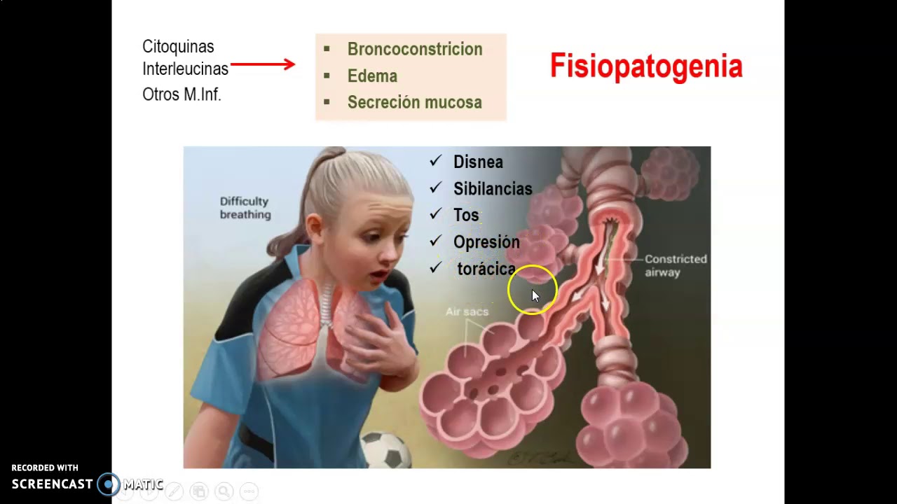 FSPTA 2024. Parte1. Sindromes obstructivos pulmonares