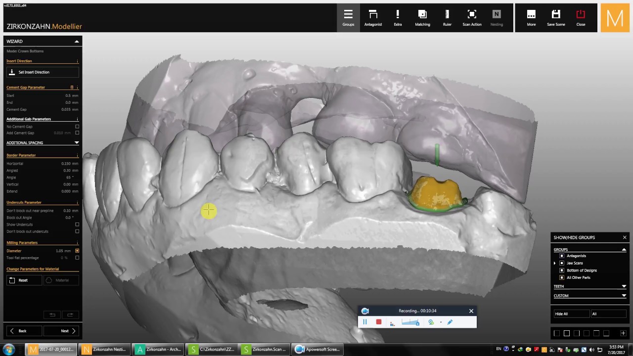 Zirkonzahn شرح مبسط للمبتدأين عن طريقه عمل 1 يونيت علي الكاد كام للمبتدأين من أ الي ي