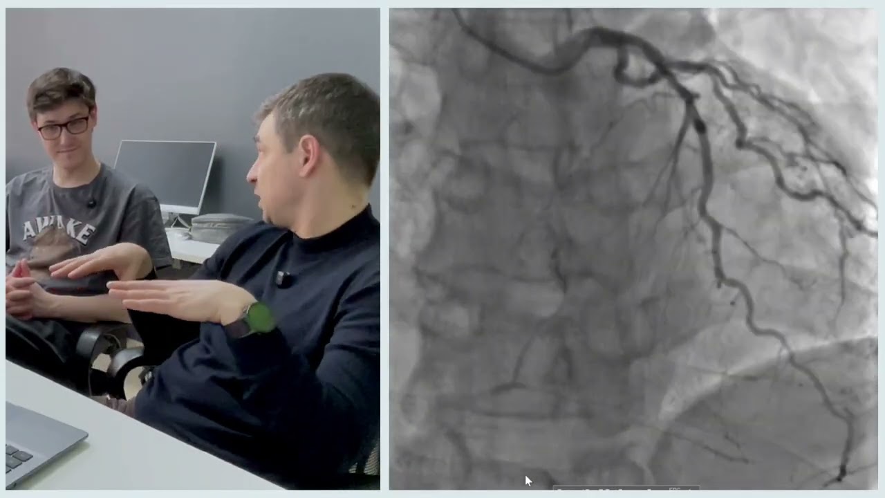 Midweek Post #3 Отбойный молоток против in-stent CTO