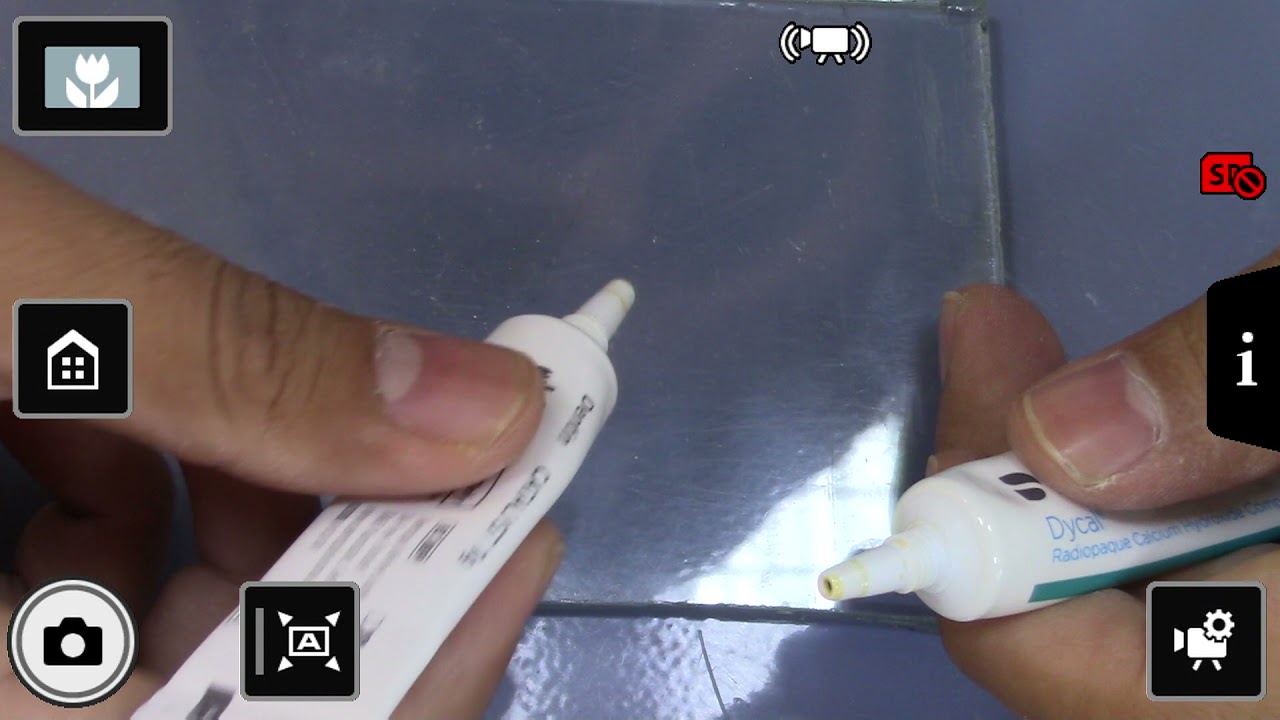 dycal uygulaması / dycal (calcium hydroxide) application