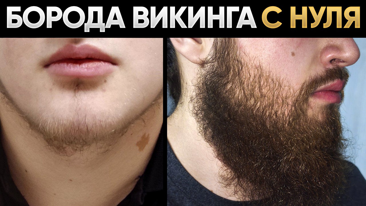 ЗАПУСТИЛ рост бороды с помощью лосьона mr.Volos/ Результаты за каждый месяц