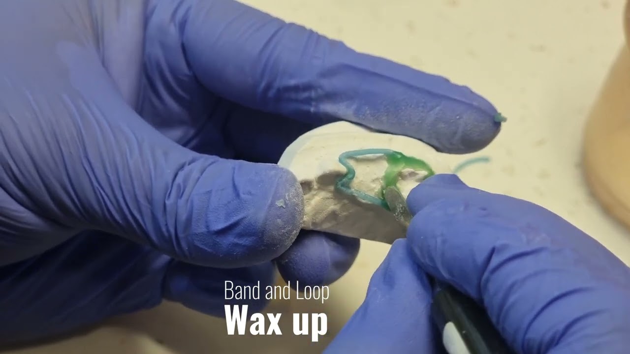 How to : Lab Fabricated Space Maintainer