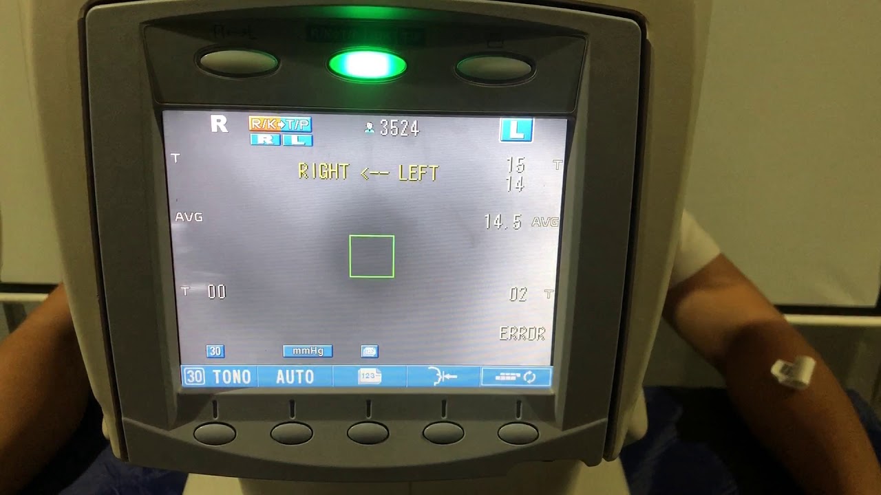 Topcon TRK-1P Automatic Auto Kerato-Refracto-Tonometer 2009 - 19110613-4151RM