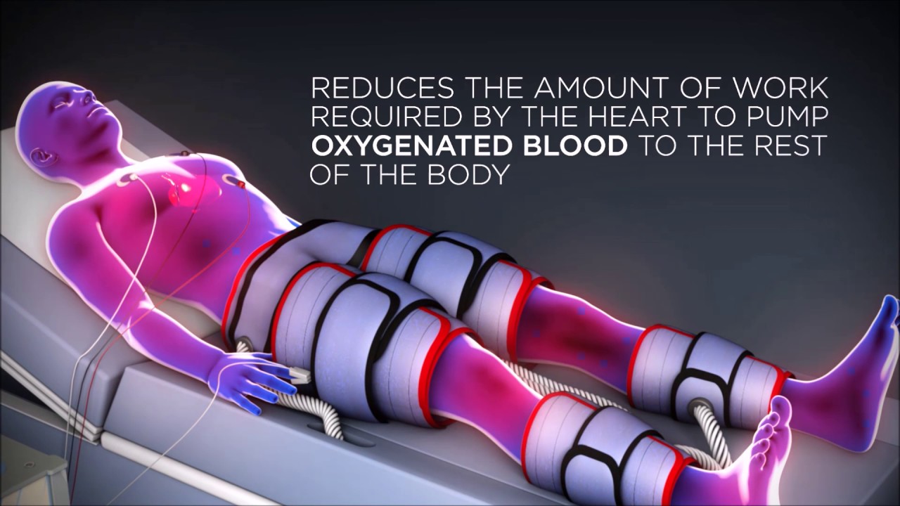 Renew ECP Therapy