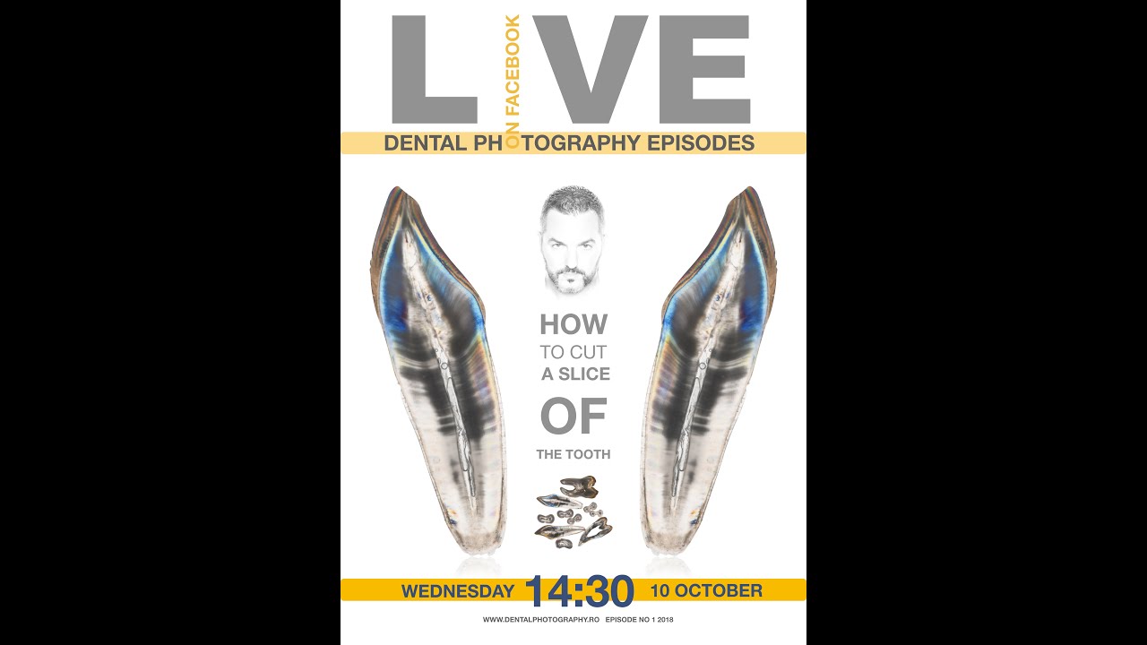 Dental photography - shoot like a pro - tooth slices