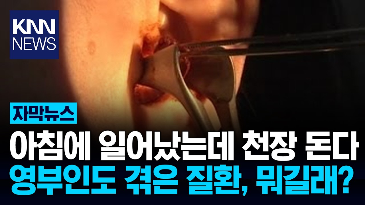 아침에 일어날 때 세상이 빙빙? 빈혈 아닌 '이것' 의심하세요! / KNN