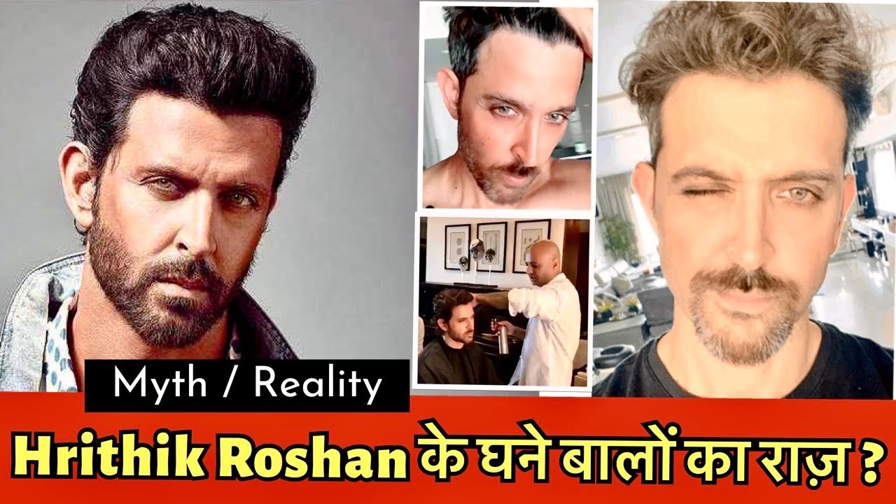 क़्या Hrithik Roshan ने Hair Transplant कराया है या नही ? | Hrithik Roshan Hair Secret Reveal